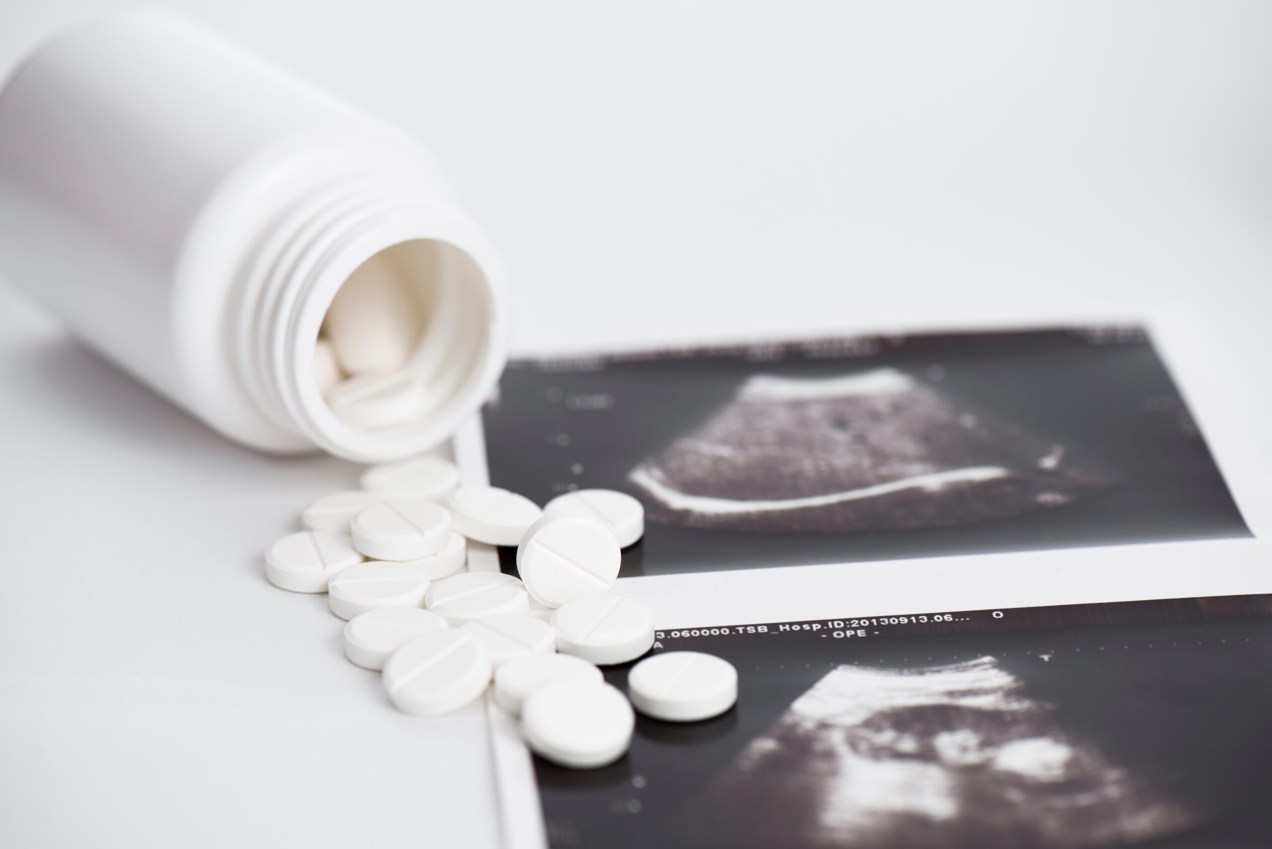Is Abortion Pill Reversal Possible and Safe?