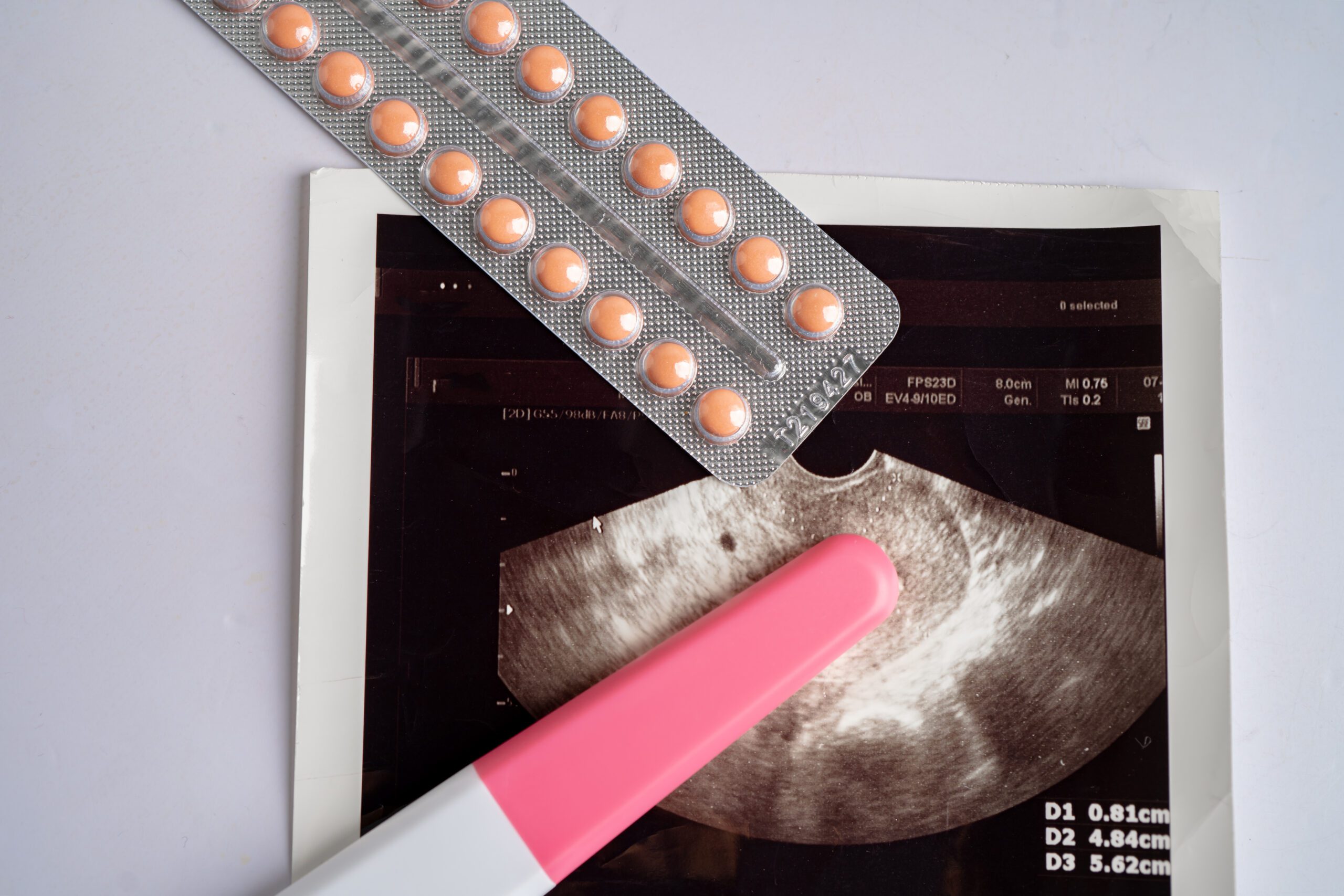 University of Minnesota College Campus Landing Page - Searching for Abortion 3 AdobeStock 695834956 scaled 1