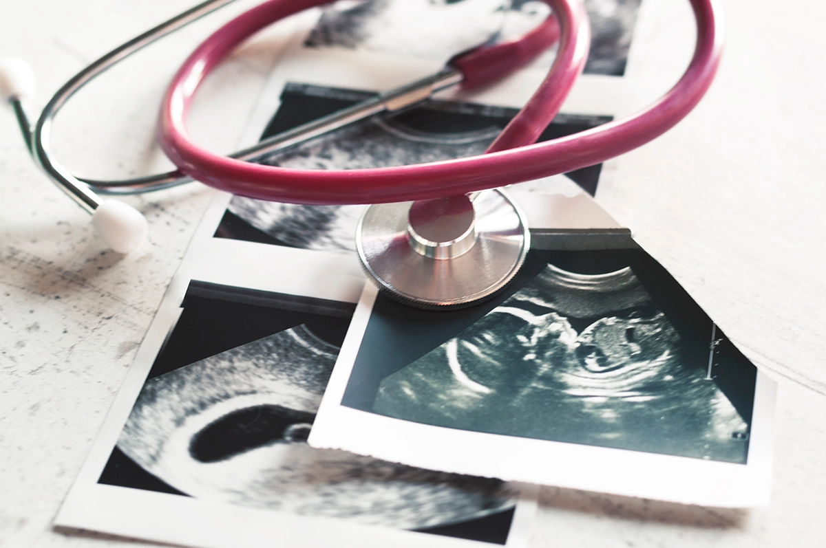 University of Minnesota College Campus Landing Page - Searching for Abortion 2 ultrasoundandpregnancy